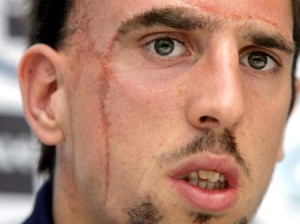 лицо мужчины со шрамом