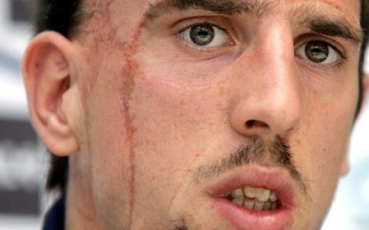 лицо мужчины со шрамом