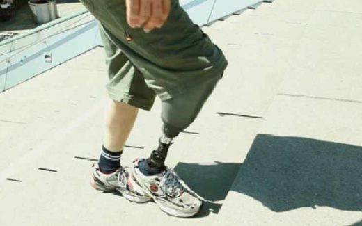 чувствительный протез ноги